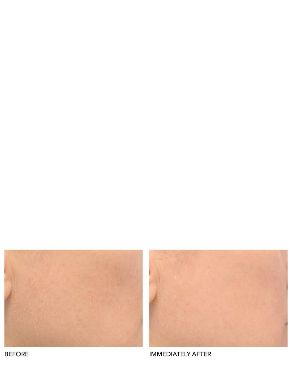 Clinical Grade Resurfacing Liquid Peel Y680