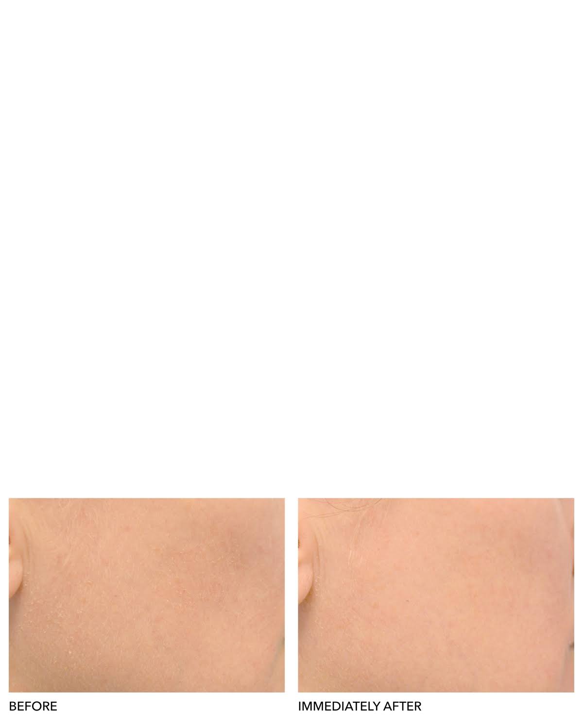 Clinical Grade Resurfacing Liquid Peel Y680
